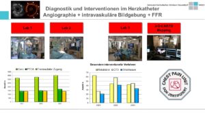 Leistungszahlen Herzkatheterlabor